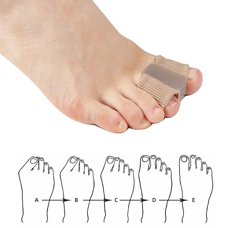 Nowy separator palców, korekto – Toe Separator Silicon recenzja i cena